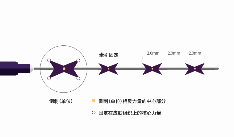 허쉬성형외과 맥스리프팅